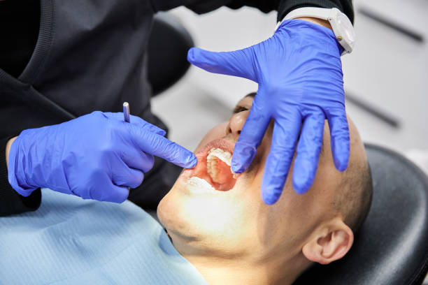 Best Broken or Chipped Tooth Repair in Grambling, LA